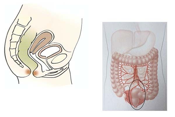 Présentation de la chirurgie du rectum et de l’anus en schémas